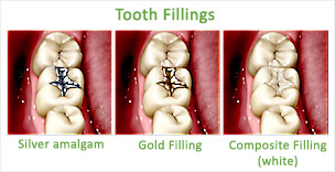 DENTAL CARE CENTRE LOWER HUTT