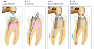 DENTAL CARE CENTRE LOWER HUTT