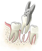 DENTAL CARE CENTRE LOWER HUTT