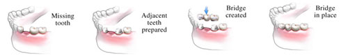 DENTAL CARE CENTRE LOWER HUTT