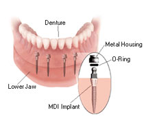 DENTAL CARE CENTRE LOWER HUTT