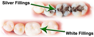 DENTAL CARE CENTRE LOWER HUTT