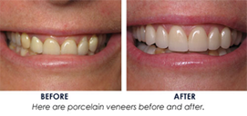 DENTAL CARE CENTRE LOWER HUTT